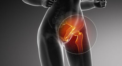 Acetabular Tears-Hip and Groin Pain – Why is There a Problem-head