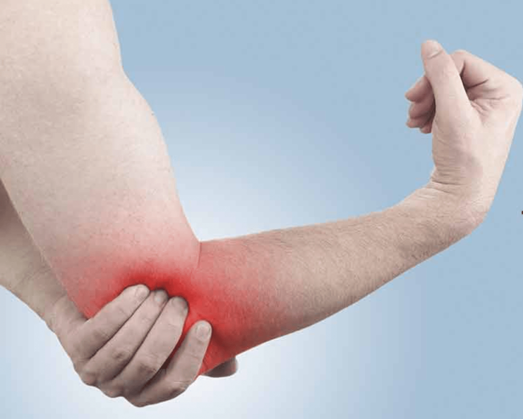 tennis elbow pain - active solutions physiotherapy floreat